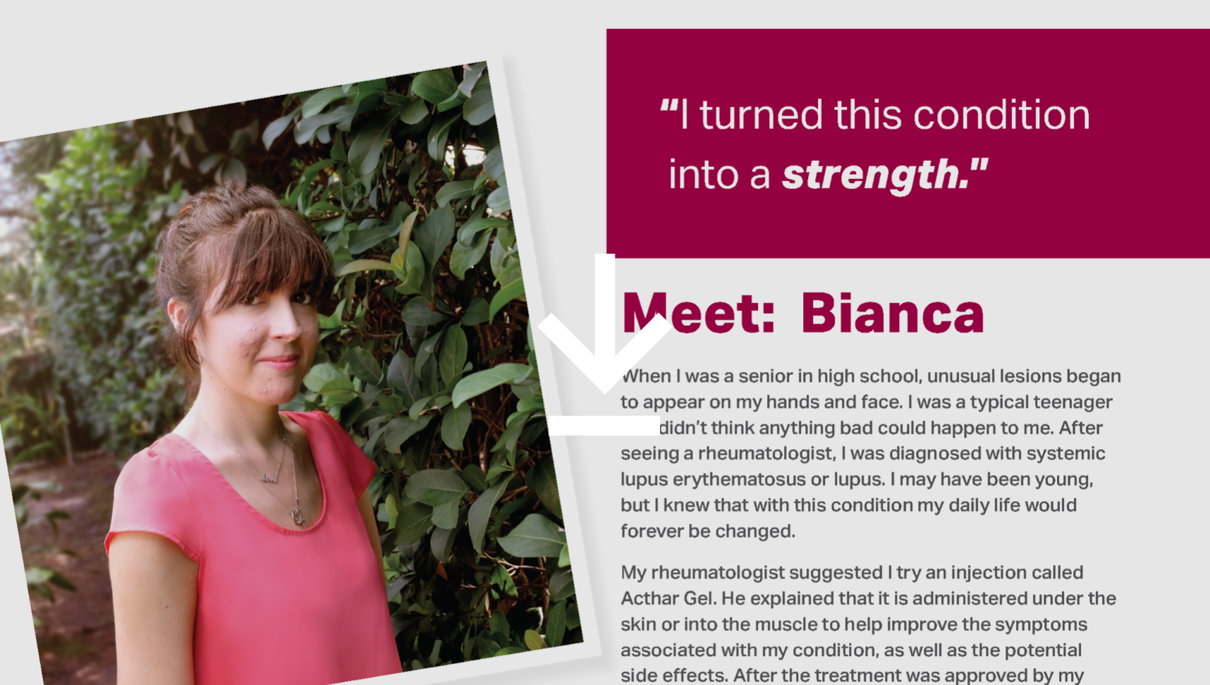 Meet Bianca (SLE)