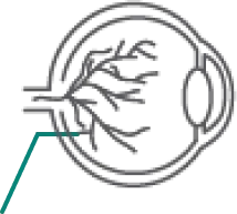 Rheumatoid Arthritis Icon